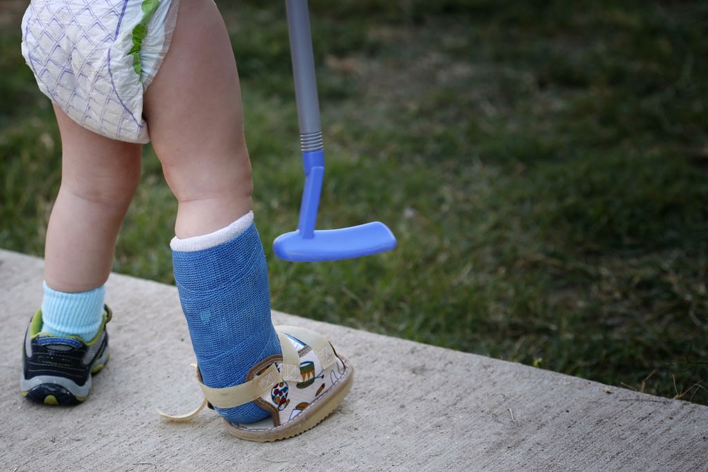 العظم الزجاجي