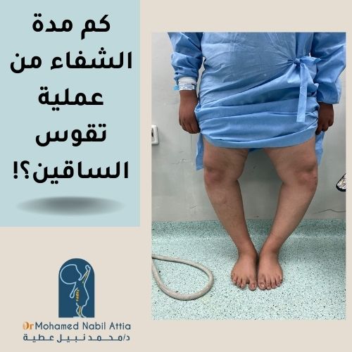 كم مدة الشفاء من عملية تقوس الساقين