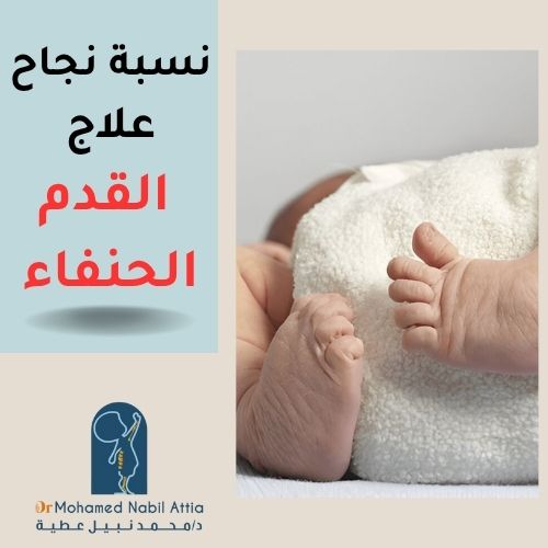نسبة نجاح علاج القدم الحنفاء