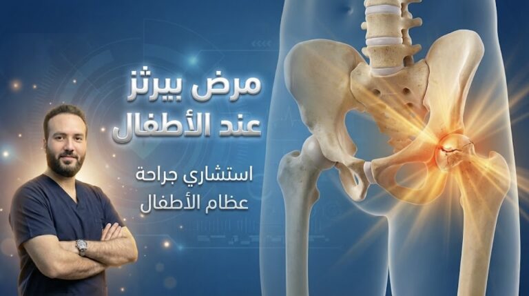 مرض بيرثز عند الأطفال